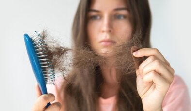 SAÇ DÖKÜLMESİNDEN NASIL KURTULABİLİRSİNİZ?