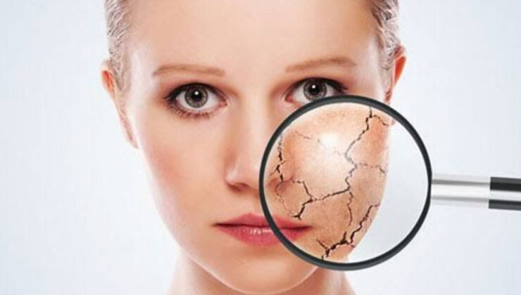 BU ALIŞKANLIKLAR CİLDİNİZİ ERKEN YAŞLANDIRIYOR