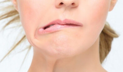 UZMANINDAN YÜZ FELCİNE KARŞI ÖNERİLER