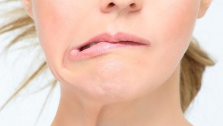 UZMANINDAN YÜZ FELCİNE KARŞI ÖNERİLER