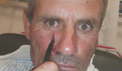 YÜZÜNE SAPLANAN BIÇAKLA HASTANEYE KALDIRILDI