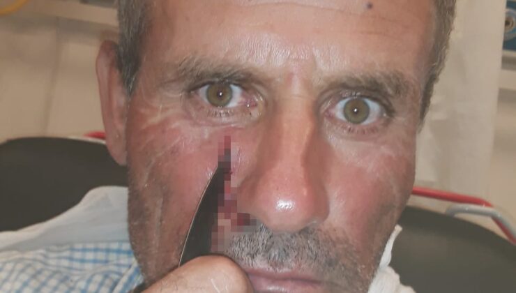 YÜZÜNE SAPLANAN BIÇAKLA HASTANEYE KALDIRILDI