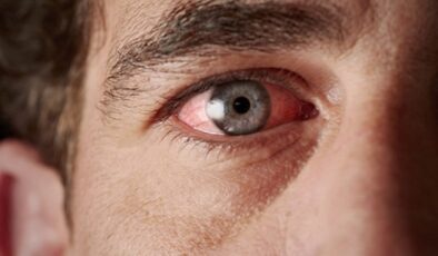 GÖRME KAYBINA NEDEN OLAN HASTALIKLARA DİKKAT!