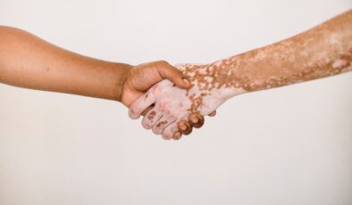 YAZ MEVSİMİNDE EN ÇOK GÖRÜLEN CİLT HASTALIKLARI