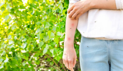 BU VİRÜS HASTALARIN YÜZDE 80’İNDE BELİRTİ VERMİYOR