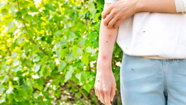 BU VİRÜS HASTALARIN YÜZDE 80’İNDE BELİRTİ VERMİYOR