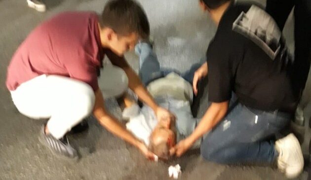 ARACIN ÇARPTIĞI YAYA AĞIR YARALANDI