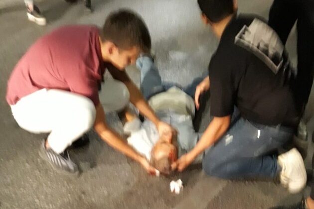 ARACIN ÇARPTIĞI YAYA AĞIR YARALANDI