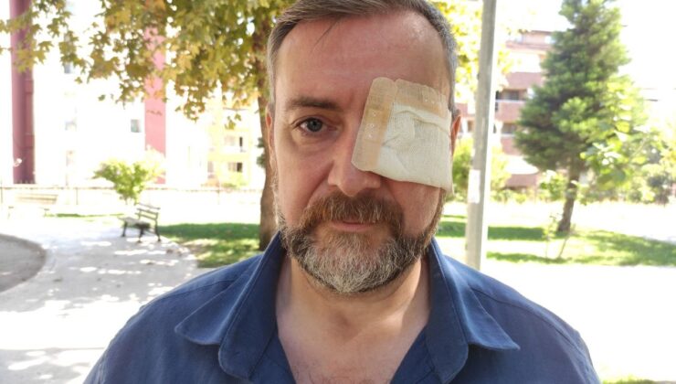 HEM GÖZÜNDEN HEM DE İŞİNDEN OLDU