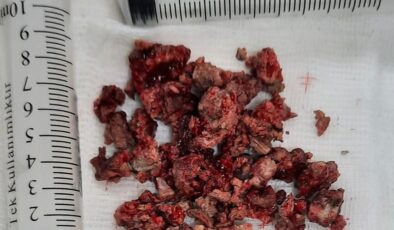 KÖTÜ KOKU GERÇEĞİ ORTAYA ÇIKARDI