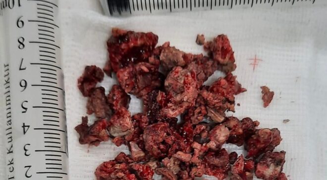 KÖTÜ KOKU GERÇEĞİ ORTAYA ÇIKARDI