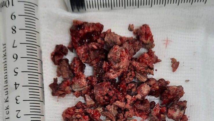 KÖTÜ KOKU GERÇEĞİ ORTAYA ÇIKARDI