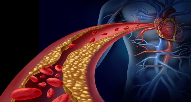 ÇÖZÜNEBİLİR LİFLER KOLESTEROLÜ DÜŞÜREBİLİR